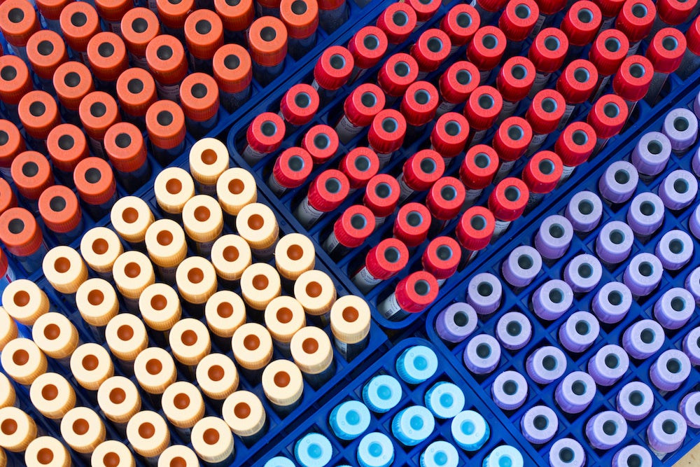 Supply materials